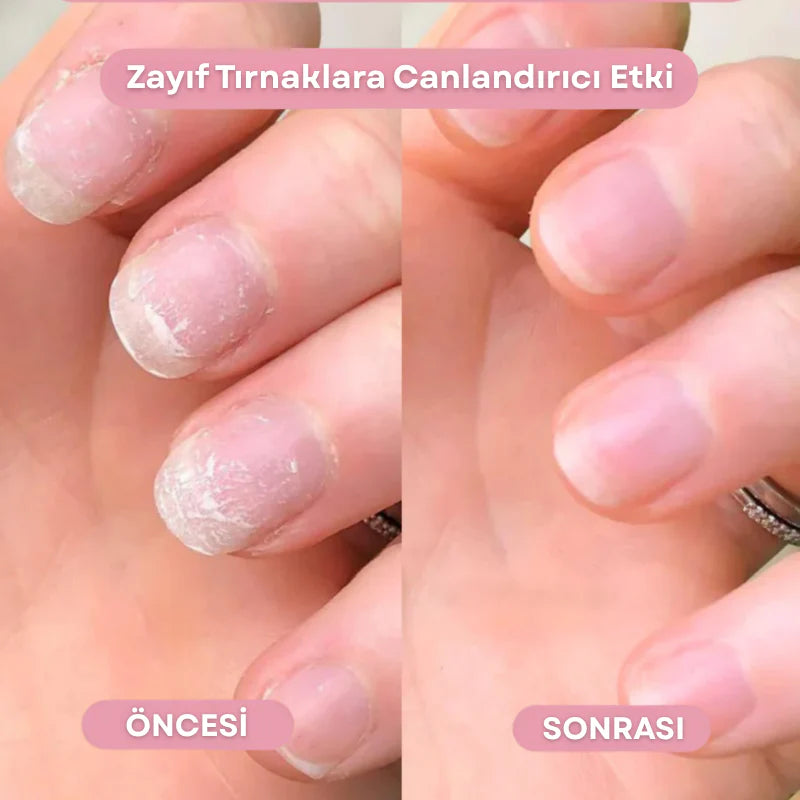 BerNail™ | Uzatıcı & Güçlendirici Bakım Yağı